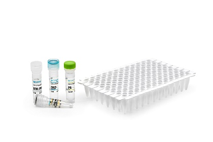 Набор реагентов «CoV-2-FluA/B-RT-PCR» для выявления РНК коронавируса SARS-CoV-2, вирусов гриппа A (Influenza A virus) и гриппа B (Influenza B virus) методом ПЦР в реальном…